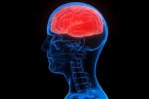 Recognizing Brain Injuries After an Accident