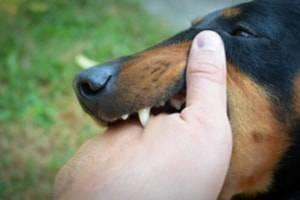 When Pet Owners Are Liable for Animal Attacks